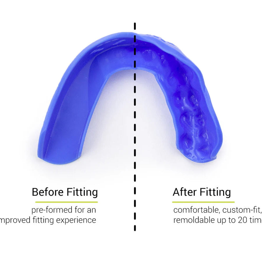 SISU 3D Youth Mouthguard